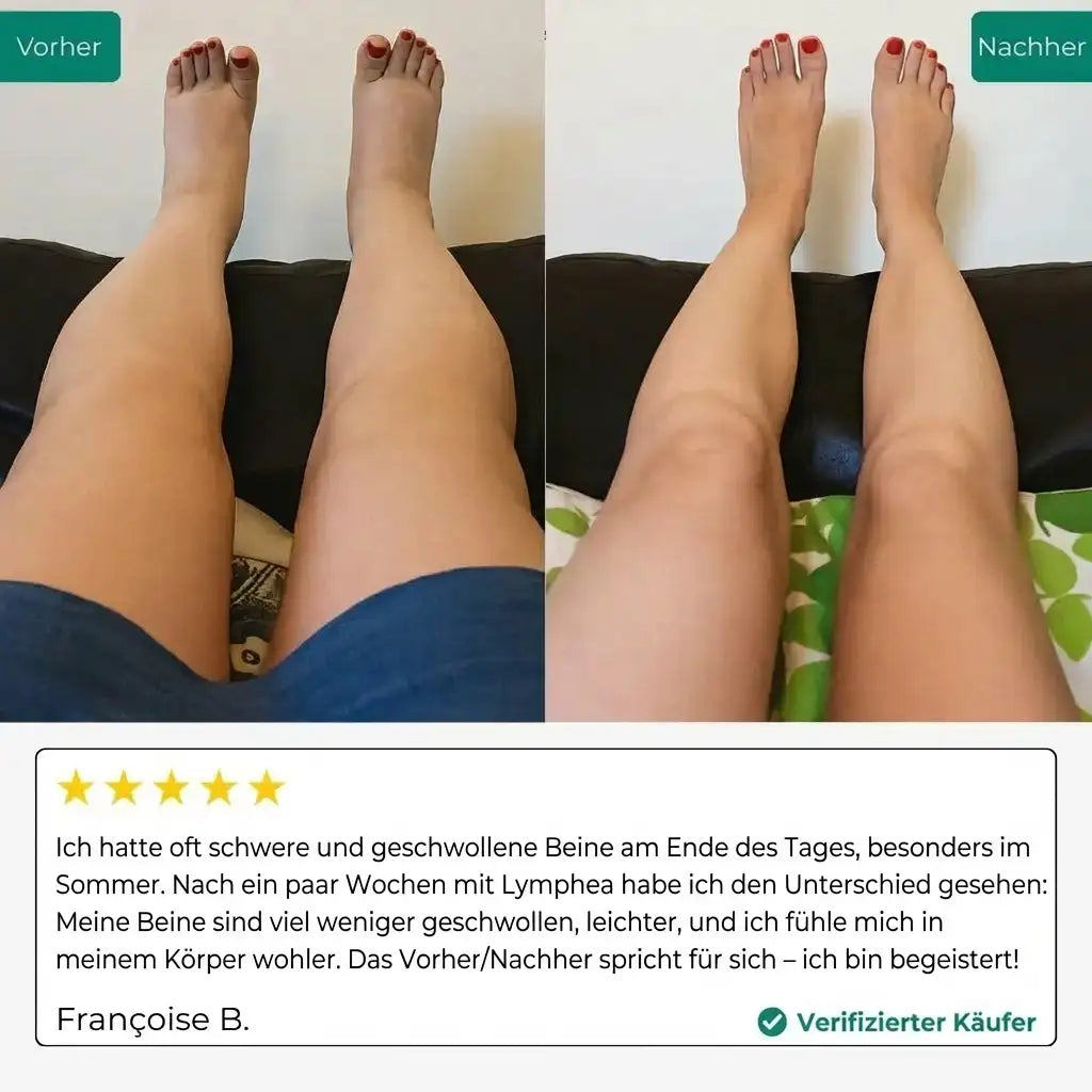 LYMPHDRAINAGE