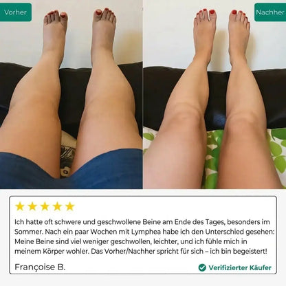 LYMPHDRAINAGE