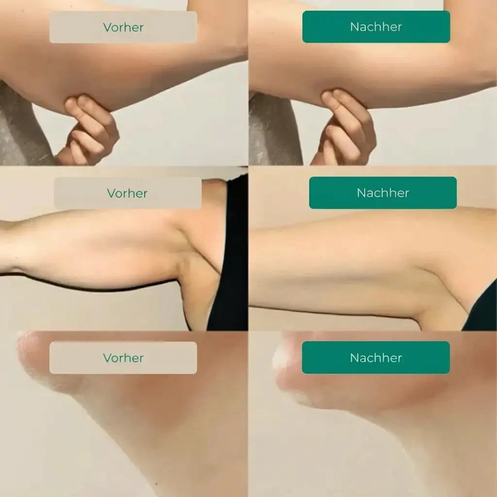 LYMPHDRAINAGE