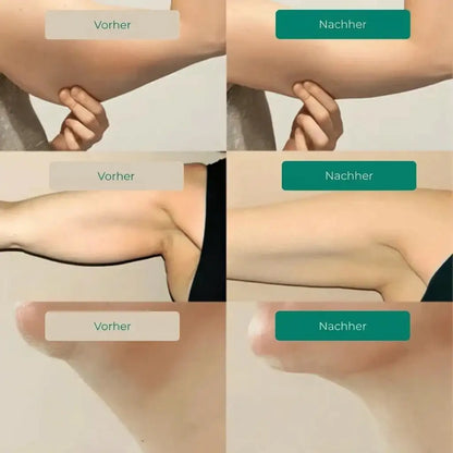 LYMPHDRAINAGE